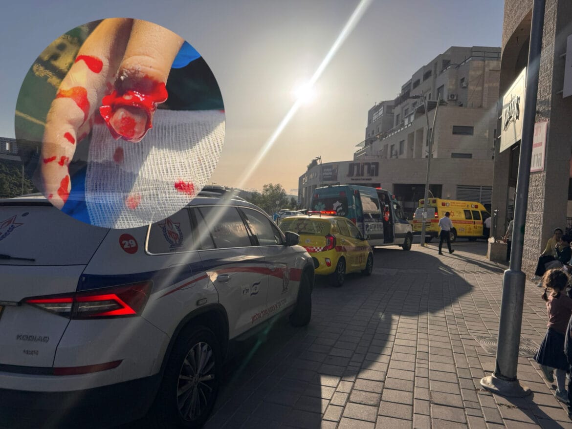 האבצבע שנקטעה וכוחות החירום בזירה